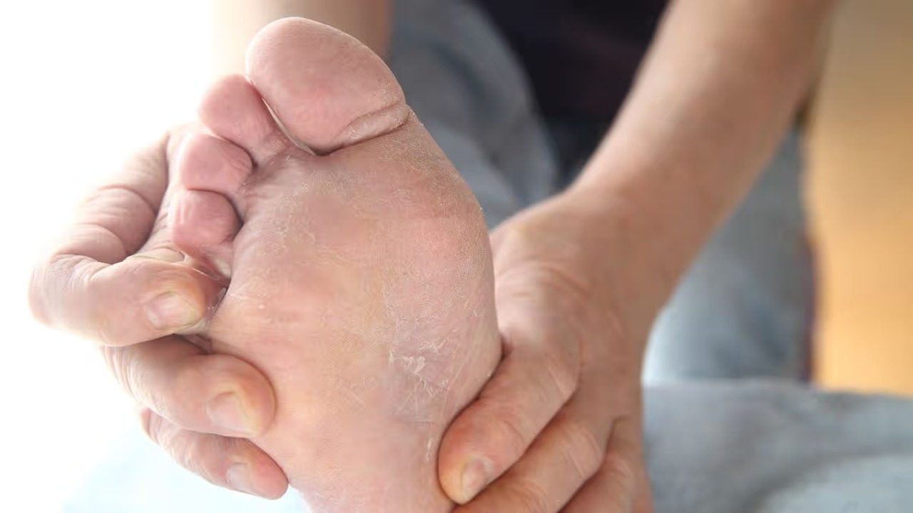 Fungal Infections: Why Yacht Cruisers Are Particularly Vulnerable